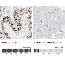 SMARCC1 Antibody, Novus Biologicals 25 &mu;L; Unlabeled:Antibodies, Polyclonal